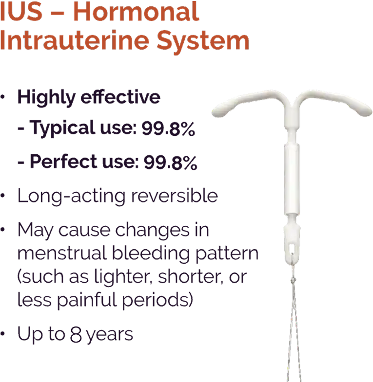 3D rendering of a Hormonal Intrauterine System